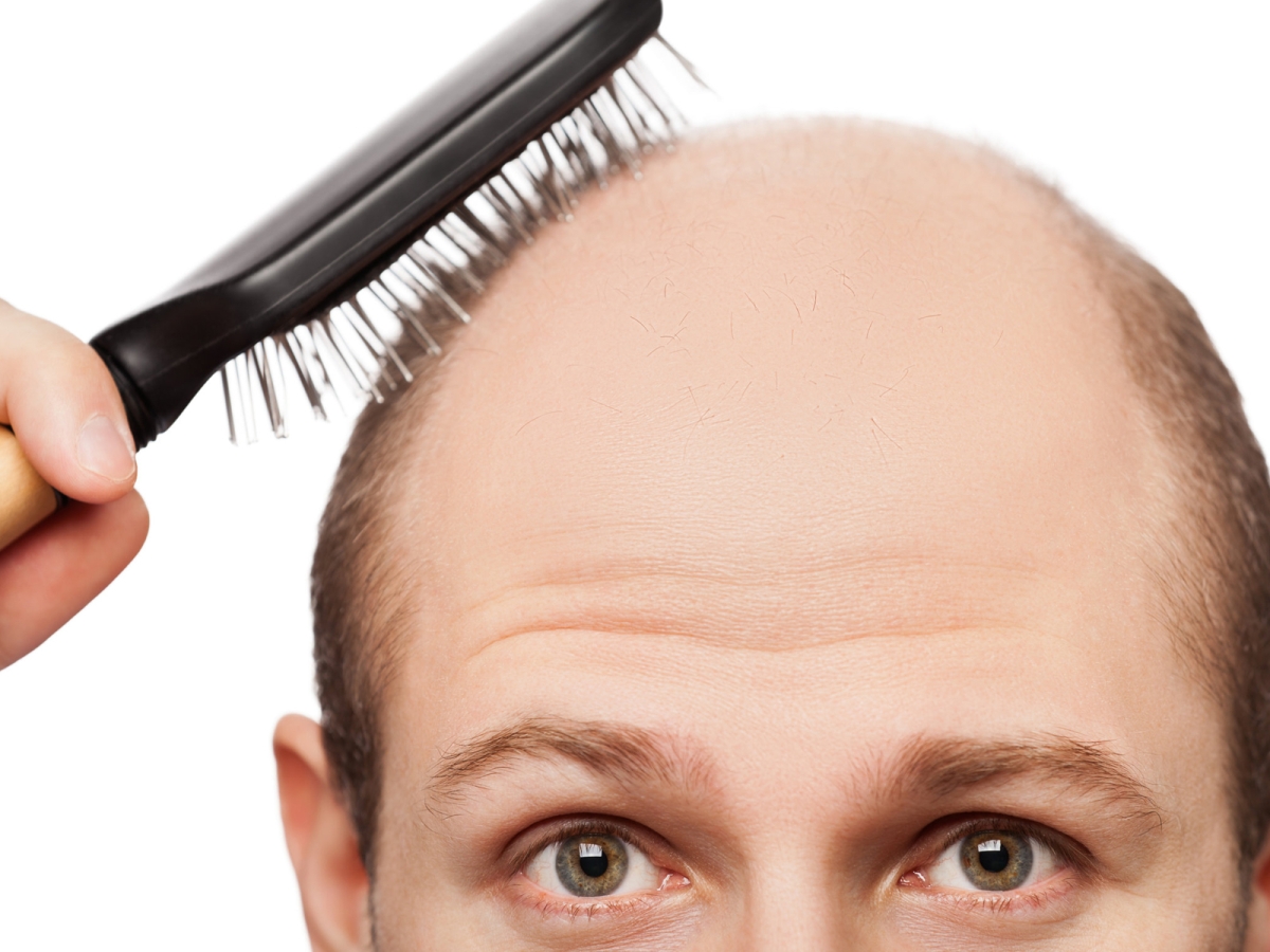 bald man brushing his remaining hair